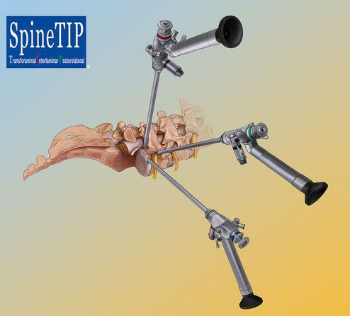 Артроскоп жесткий Karl Storz HOPKINS для SpineTIP - изображение 3