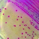 Агар МакКонки c кристаллвиолетом и 0.15% желчных солей MacConkey Agar with CV, NaCl and 0.15% Bile Salts (M081)