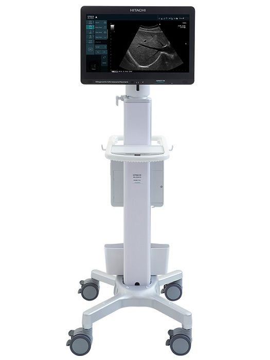 УЗИ аппарат Hitachi Arietta Precision - изображение 2