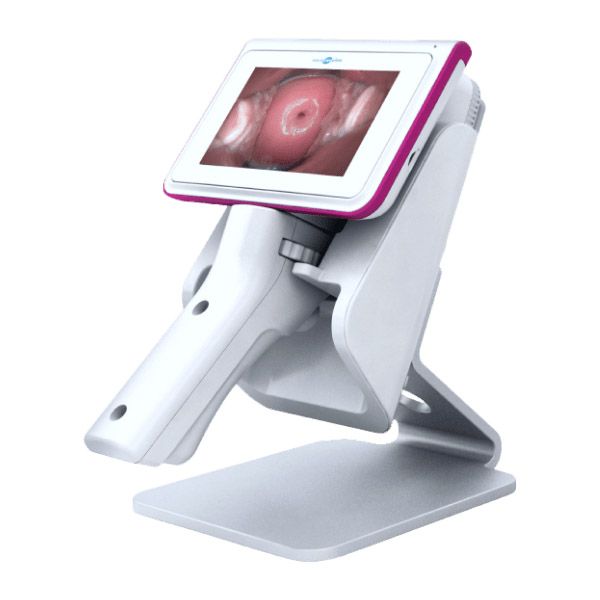 Система скрининга рака шейки матки Dr. CerviCARE AI - изображение 2