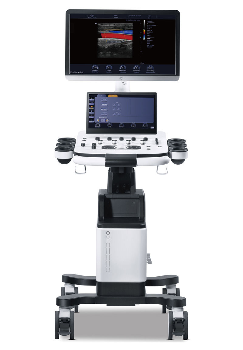 УЗИ аппарат Focus & Fusion Danus 30