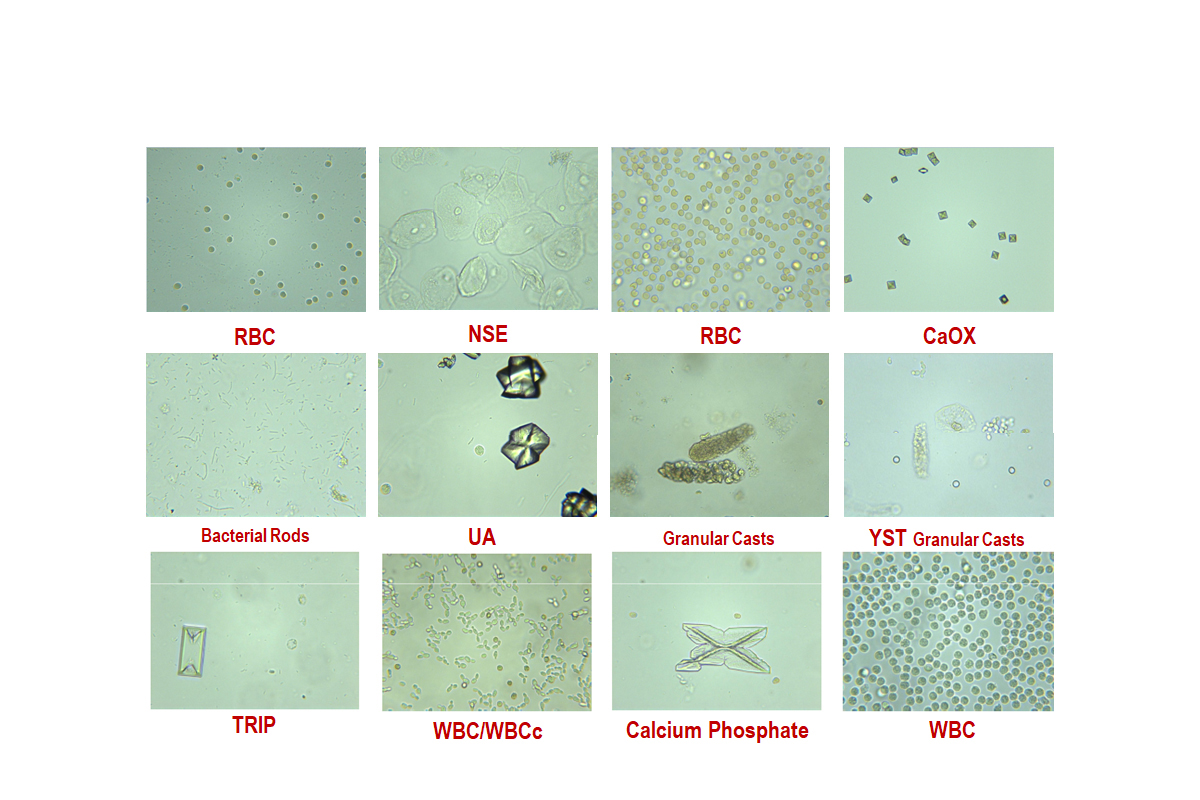 Анализатор мочи Erba Laura XL - изображение 5