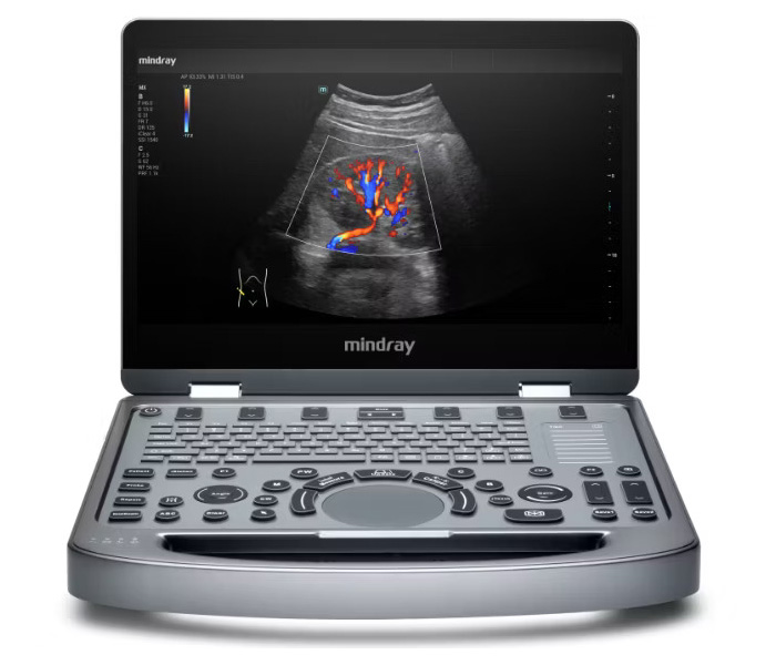 УЗИ аппарат Mindray MX6