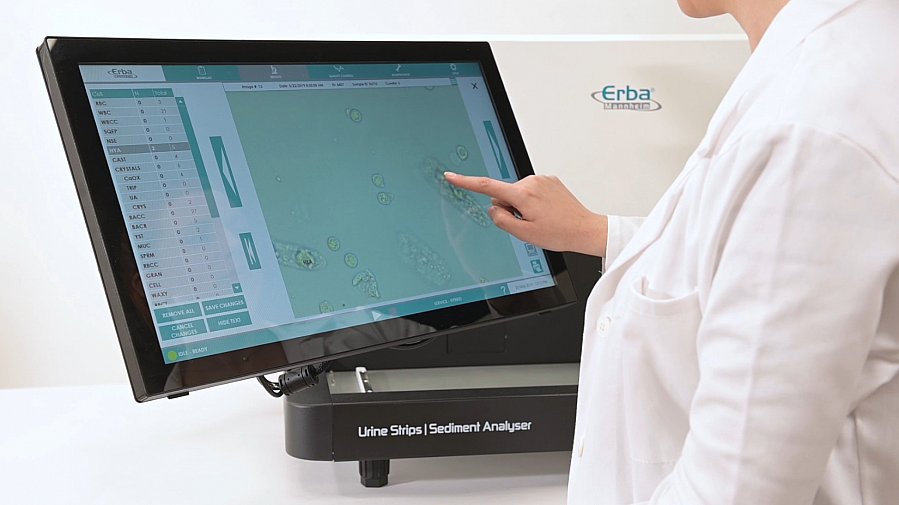 Анализатор мочи Erba Laura XL - изображение 2