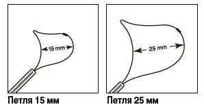 Петля для полипэктомии AcuSnare (Duck Bill) ASDB-15-015 мягкая, одноразовая