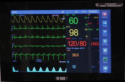 Монитор пациента Медтехноцентр М-300-15 - изображение 2