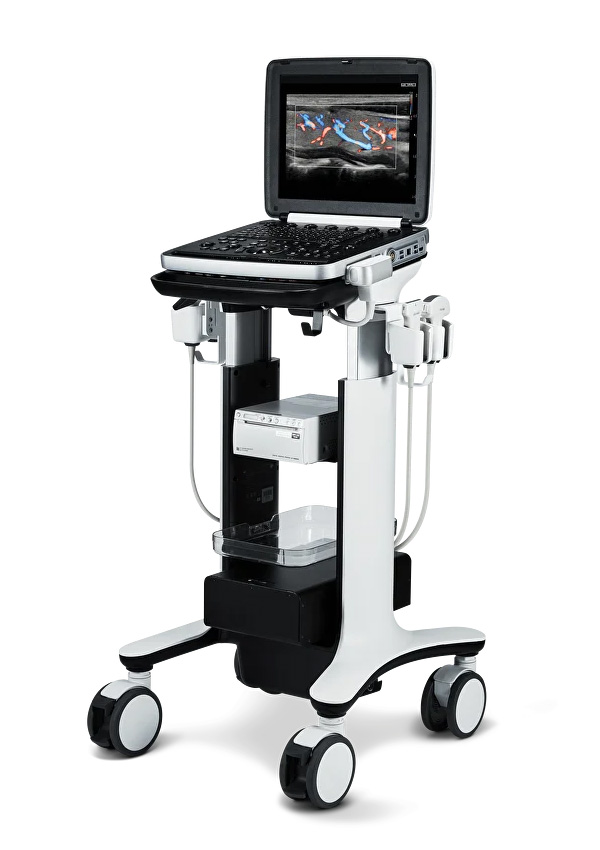 УЗИ аппарат РуСкан 70П