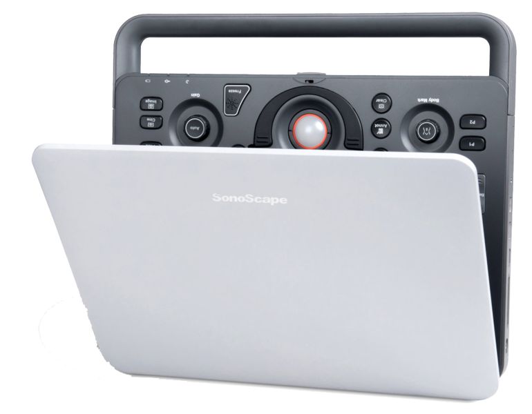УЗИ аппарат SonoScape S2N - изображение 3
