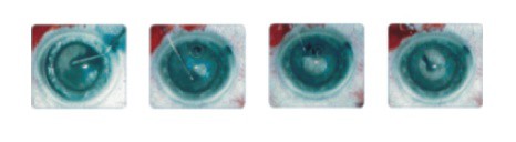 Раствор трипанового синего DORC Vision Blue - изображение 2