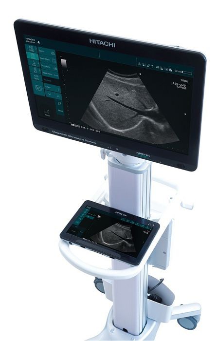 УЗИ аппарат Hitachi Arietta Precision