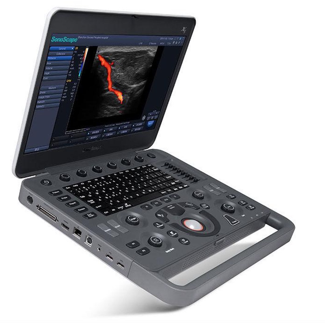 УЗИ аппарат SonoScape X5