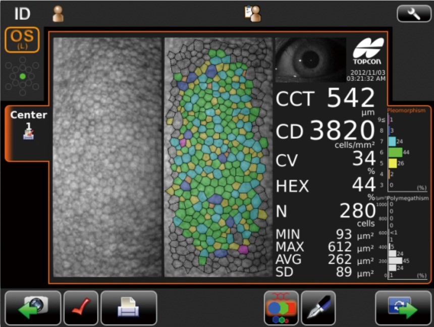 Эндотелиальный микроскоп Topcon SP-1P - изображение 2