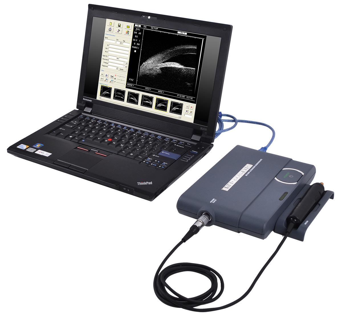 Ультразвуковой биомикроскоп MEDA MD-320W