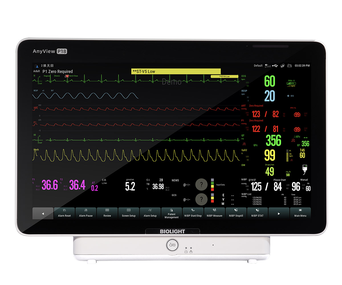Монитор пациента BLT AnyView P18 - изображение 2