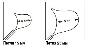 Петля для полипэктомии AcuSnare (Duck Bill) ASDB-25-015 мягкая, одноразовая