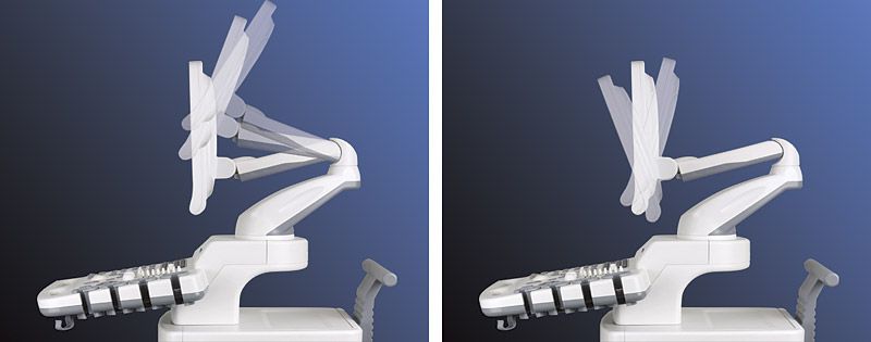 УЗИ аппарат SonoScape SSI-6000 - изображение 2