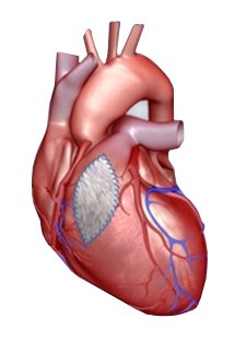 Мембрана хирургическая CorMatrix для восстановления сердечной ткани
