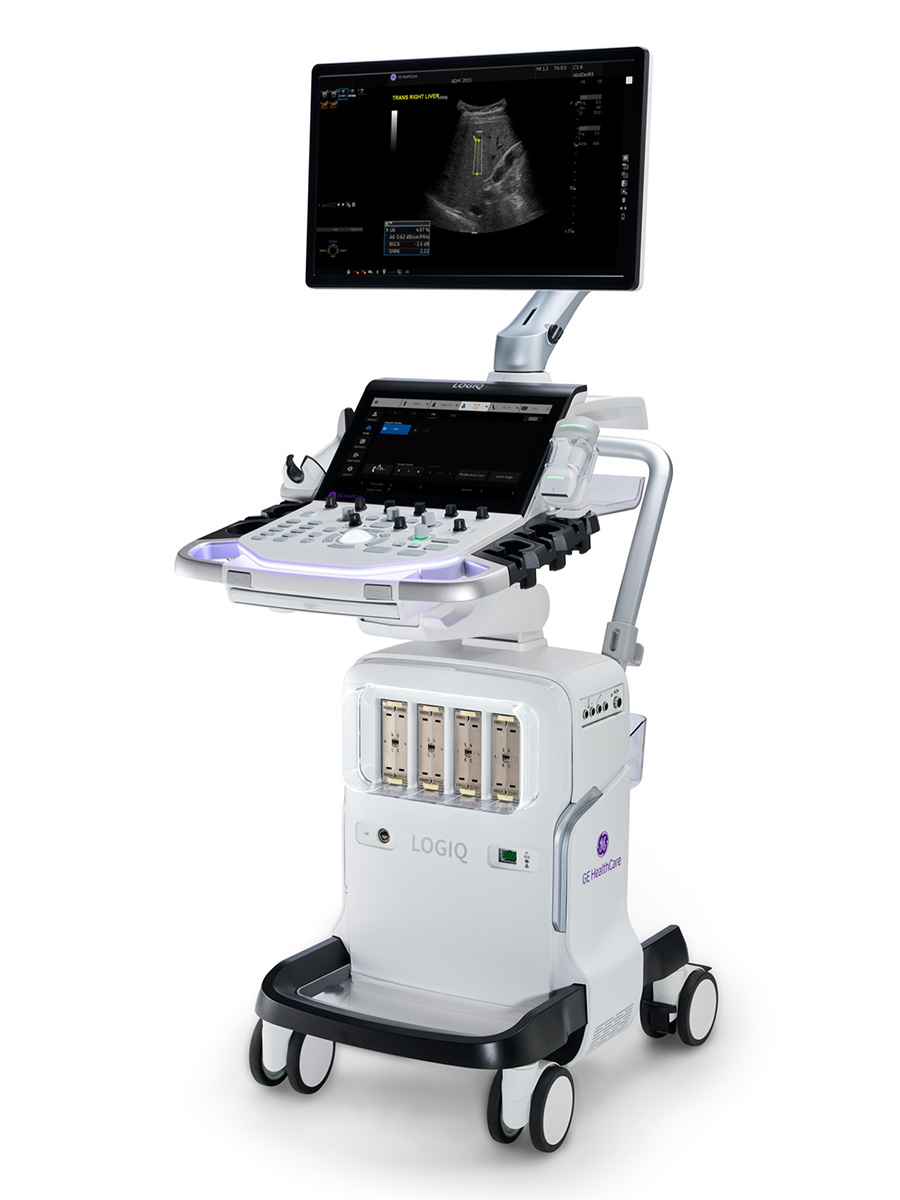 УЗИ аппарат GE Logiq Totus