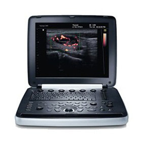 УЗИ аппарат РуСкан 70П - изображение 3