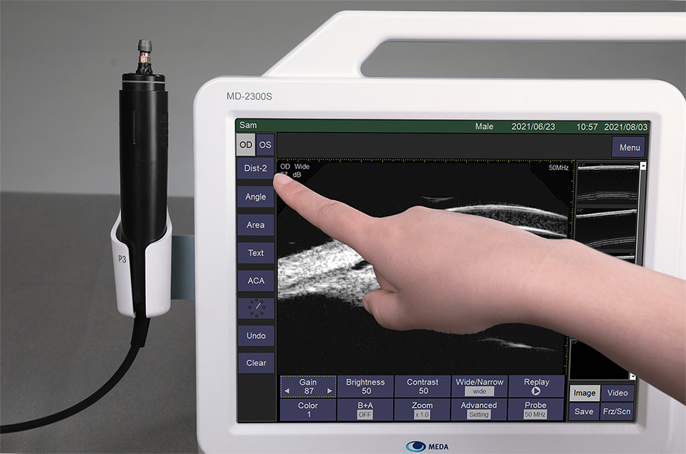 Ультразвуковой A/B сканер MEDA MD-2300S - изображение 2