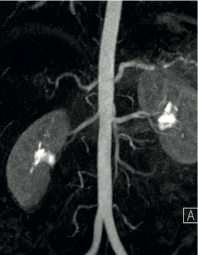 Система инъекционная для МРТ MEDRAD MRXperion - изображение 5