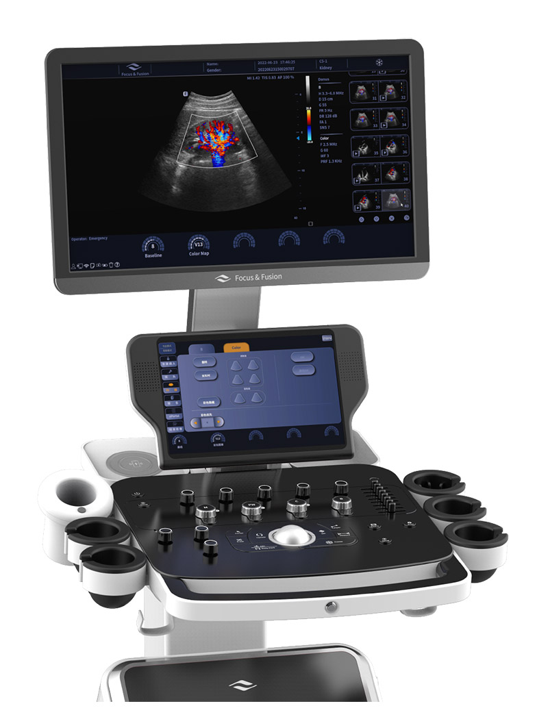 УЗИ аппарат Focus & Fusion Danus 10