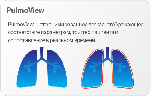 Аппарат ИВЛ Comen V1 - изображение 3