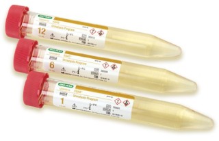 EQAS программа (контроль) по общему анализу мочи / EQAS Urinalysis Program