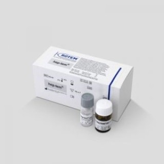 Дифференциал гепаринового эффекта Hep-tem