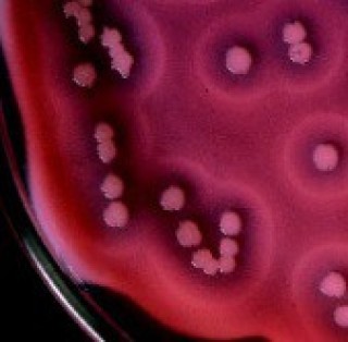 Основа желточного агара с полимиксином MYP Agar Base (M636)