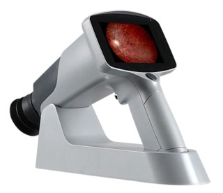 Фундус-камера ручная MediWorks FC161