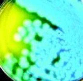 Основа агара для Bacillus cereus Bacillus cereus Agar Base(M833)