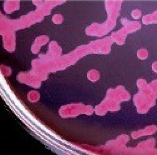 Агар МакКонки модифицированный MacConkey Agar, Modified (M051)