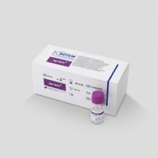 Подтверждение гиперфибринолиза (t) ap-tem