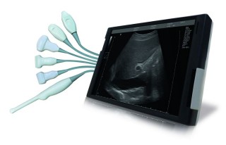 УЗ-сканер Ассомедика SmartEcho 128