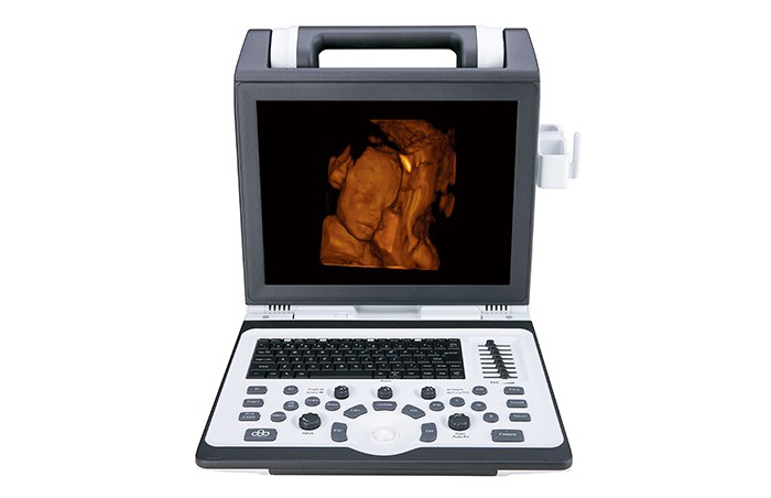УЗИ аппарат SIUI CTS-8800