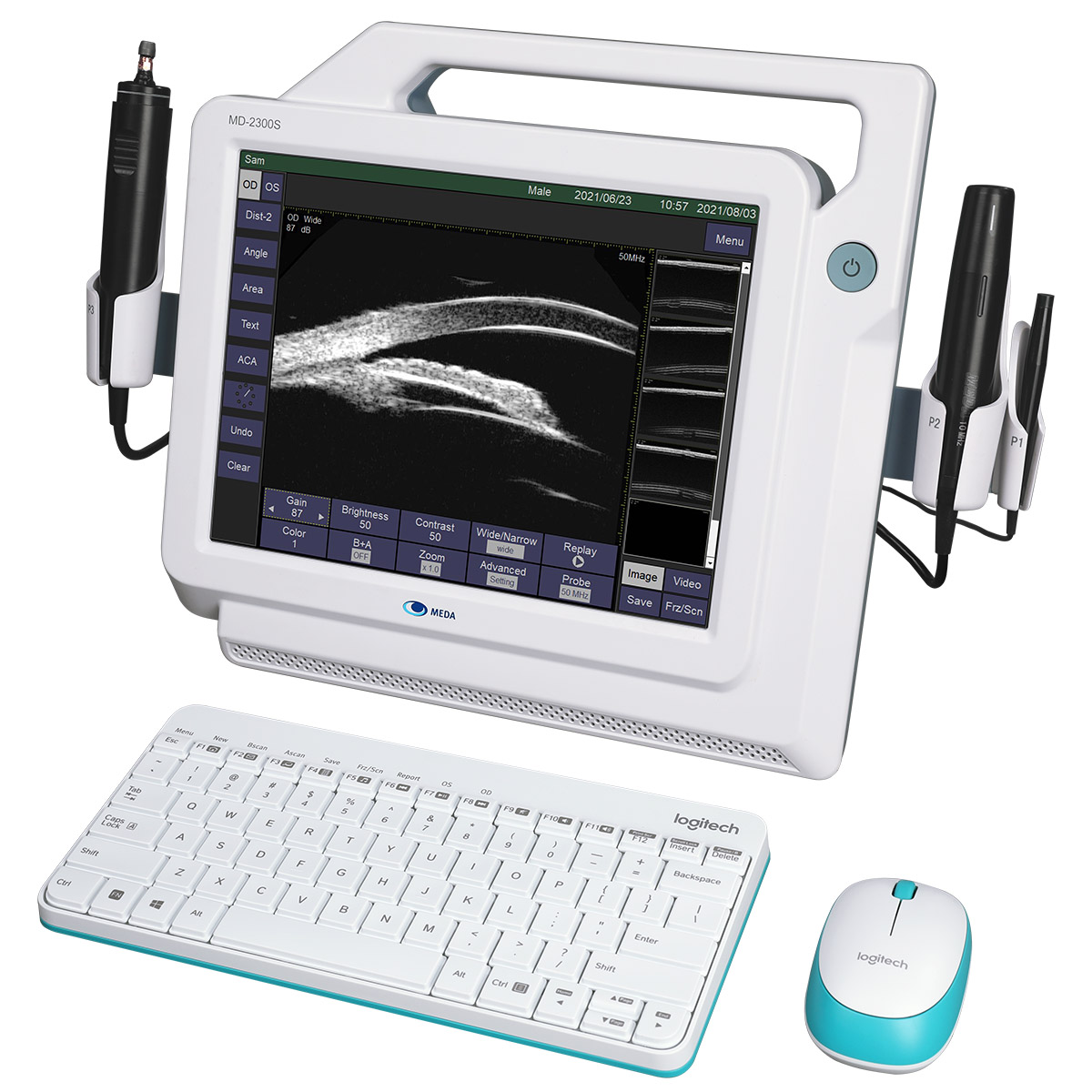 Ультразвуковой A/B сканер MEDA MD-2300S