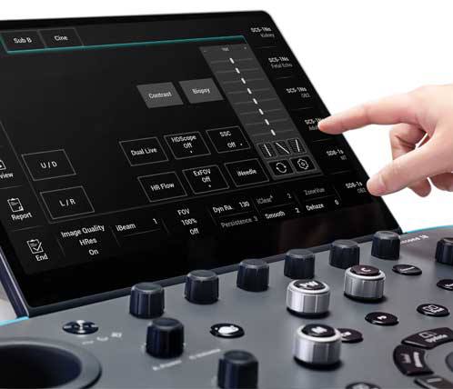 УЗИ аппарат Mindray Resona I8 - изображение 4