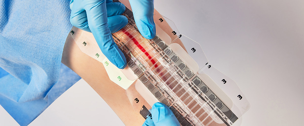 Фиксатор швов Foldable Skin Closure - изображение 2