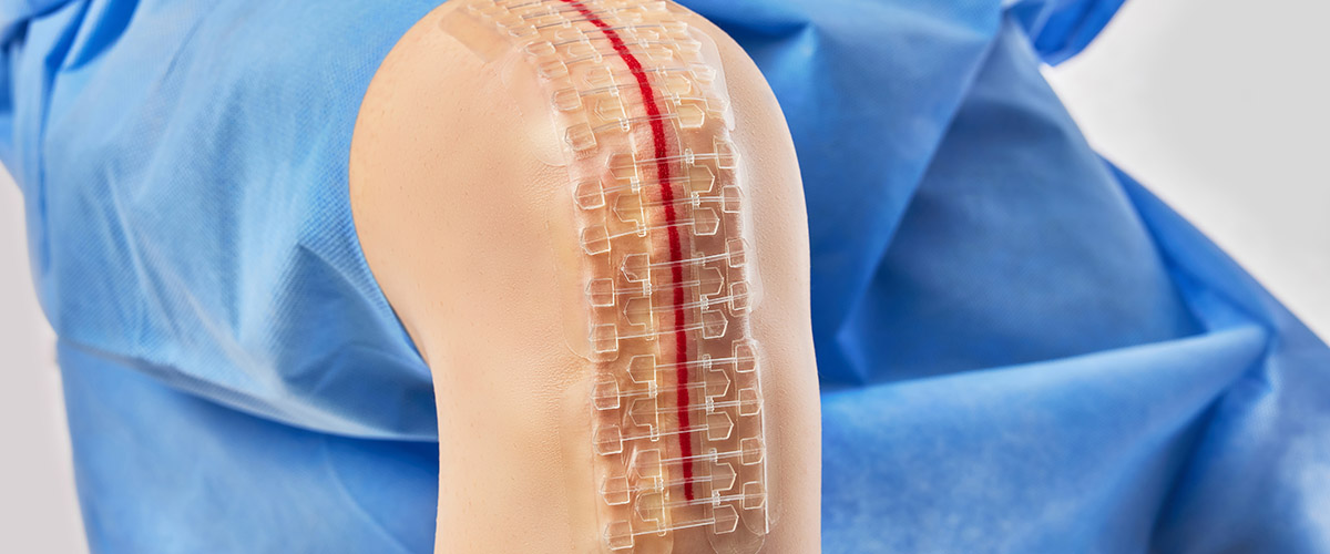 Фиксатор швов Foldable Skin Closure - изображение 3